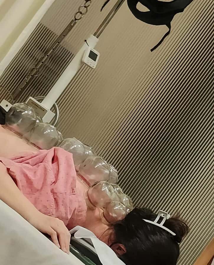 Traditional Chinese Medicine AcupunctureCupping Experience - How the Experience Enhances Your Visit